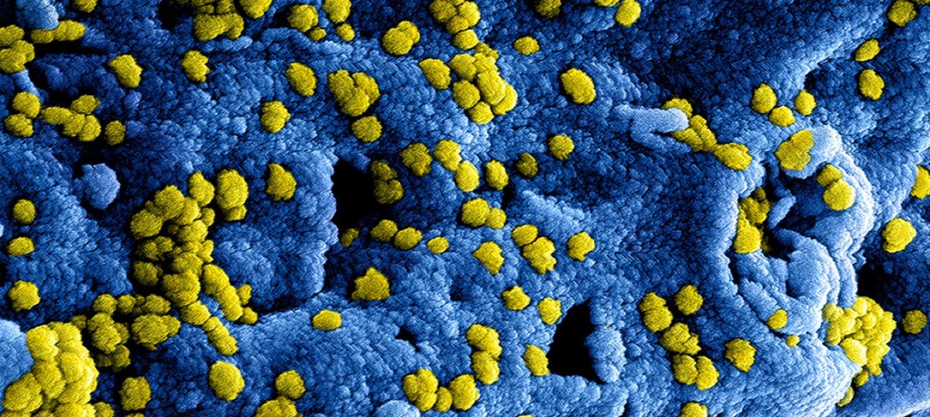 Coronavirus Instituto Nacional de Enfermedades Alérgicas e Infecciosas de Estados Unidos