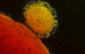 Virus gigantes, la pieza inesperada para explicar el origen de la vida compleja