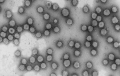 Brote de hantavirus en un crucero: impacto y reflexión desde la salud pública